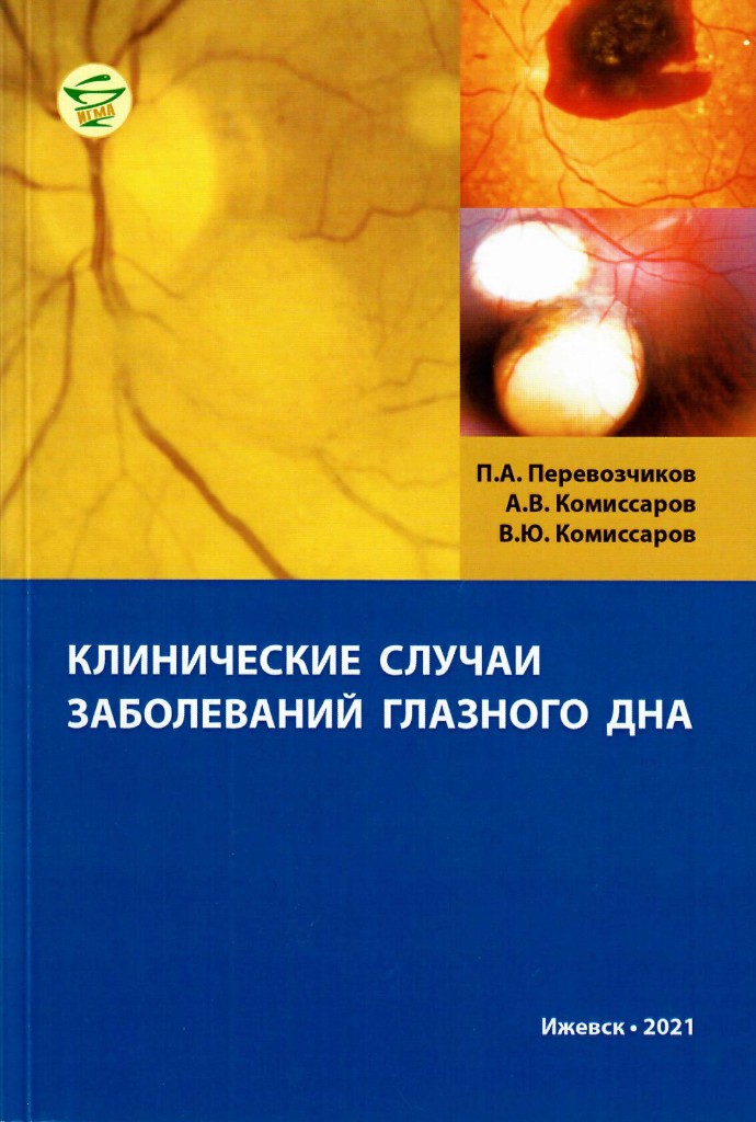 П.А. Перевозчиков, А.В. Комиссаров, В.Ю. Комиссаров. Клинические случаи заболеваний глазного дна. Ижевск 2021