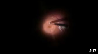 Превью видео 3