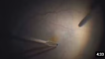 Превью видео 1